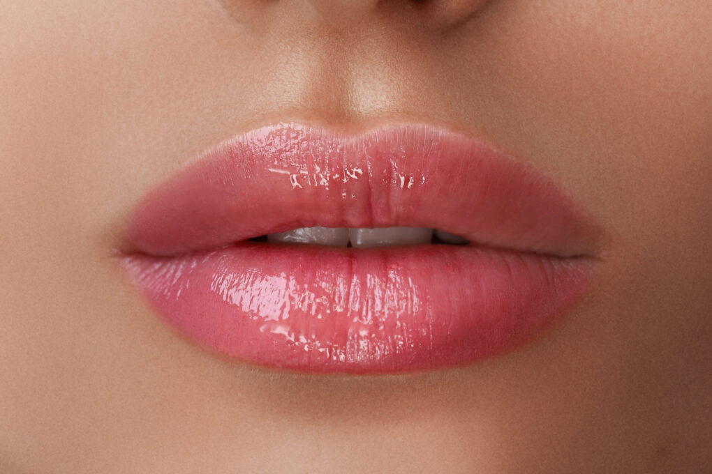 AUMENTO DE LABIOS
