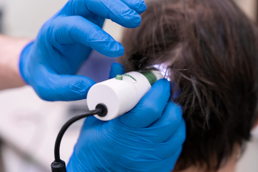Análisis capilar con tecnología digital en clínica estética