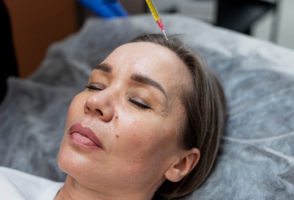 PRP facial con plasma rico en plaquetas para rejuvenecimiento