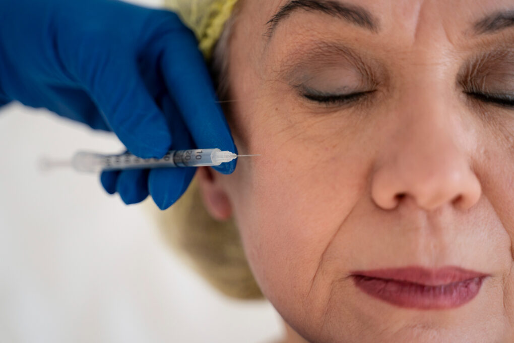 Polinucleótidos para rejuvenecimiento facial y calidad de la piel
